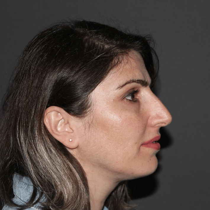 Case 1 - before procedure