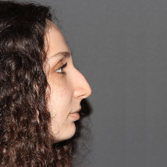 Case 2 - before procedure